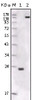 Western blot analysis using FER monoclonal antibody against truncated FER - His recombinant protein and NIH / 3T3 cell lysate.