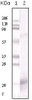 Western blot analysis using IFN - gamma monoclonal antibody against truncated IFN - gamma recombinant protein.