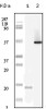 Western blot analysis using LYN monoclonal antibody against truncated LYN recombinant protein and HL60 cell lysate.