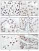 Immunohistochemical analysis of paraffin-embedded rat liver tissue (A) , human brain tumor (B) , breast cancer (C) , esophageal epithelium tissue (D) , mouse brain tissue (E) and stomach tisue (F) , showing nuclear localization using P16 mouse mAb with DAB staining.