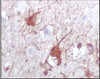 <b>Below:</b>Immunohistochemical analysis of paraffin - embedded human brain tissue (A) and human thymus tissue (B) , showing cytoplasmic localization using anti - S100B antibody with DAB staining.