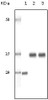 Western blot analysis using SRA monoclonal antibody against truncated SRA recombinant protein human ovary cancer tissue lysate and A431 cell lysate .