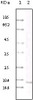 Western blot analysis using MCP - 1 monoclonal antibody against truncated MCP - 1 recombinant protein.