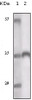 Western blot analysis using Tyro3 antibody against truncated Tyro3 recombinant protein.