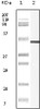 Western blot analysis using Vimentin monoclonal antibody against truncated Vimentin recombinant protein