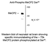 Western blot of neonatal rat brain showing specific immunolabeling of the ~75k MeCP2 protein phosphorylated at Ser80.