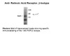 Western blot of hippocampal lysate showing specific immunolabeling of the ~48k RAR-beta isotype.