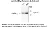 Western blot of rat cerebellar (Cb) and hippocampal (Hipp) lysates showing specific immunolabeling of the ~55k beta1-subunit of the GABAA receptor.