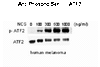 Western blot of human melanoma cells incubated with varying doses of the radiometric drug NCS showing phospho-specific immunolabeling of the ATF2 protein phosphorylated at Ser 490, 498.