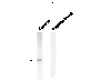 Western blot of human T47D cells showing phospho-specific immunolabeling of the ~42k-44k ERK/MAPK protein doublet.