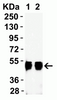 <strong>Figure 1 Western Blot Validation with Human Recombinant Protein</strong><br> Loading: 50 ng per lane of human nucleocapsid recombinant protein. Antibodies: SARS-CoV-2 nucleocapsid, 35-580, 1h incubation at RT in 5% NFDM/TBST. Secondary: Goat anti-mouse IgG HRP conjugate at 1:5000 dilution. Lane 1: 1 μg/mL Lane 2: 2 μg/mL