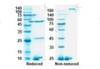 SDS-PAGE analysis Coomassie blue staining