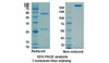 Bevacizumab (VEGFA) Antibody, Monoclonal | 10-068