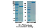 Daclizumab (IL2RA) Antibody, Monoclonal | 10-069