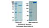 Pembrolizumab (PDCD1/PD1/CD279) Antibody, Monoclonal | 10-615