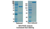Sarilumab (IL6R/CD126) Antibody, Monoclonal | 10-475