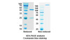 Trastuzumab Emtansine (ERBB2/EGFR2/CD340) Antibody, Monoclonal | 10-444