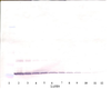 To detect hArtemin by Western Blot analysis this antibody can be used at a concentration of 0.1 - 0.2 ug/ml. Used in conjunction with compatible secondary reagents the detection limit for recombinant hArtemin is 1.5 - 3.0 ng/lane, under either reducing or non-reducing conditions.