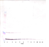 To detect hMIA by Western Blot analysis this antibody can be used at a concentration of 0.1 - 0.2 ug/ml. Used in conjunction with compatible secondary reagents the detection limit for recombinant hMIA is 1.5 - 3.0 ng/lane, under either reducing or non-reducing conditions.