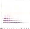 To detect human GRO-beta by Western Blot analysis this antibody can be used at a concentration of 0.1-0.2 ug/ml. When used in conjunction with compatible secondary reagents, the detection limit for recombinant Human GRO-beta is 1.5-3.0 ng/lane, under either reducing or non-reducing conditions.