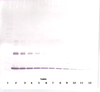 To detect mIL-1-alpha by Western Blot analysis this antibody can be used at a concentration of 0.1-0.2 ug/ml. Used in conjunction with compatible secondary reagents the detection limit for recombinant mIL-1-alpha is 1.5-3.0 ng/lane, under either reducing or non-reducing conditions.
