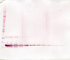 To detect hsTNF Receptor II by Western Blot analysis this antibody can be used at a concentration of 0.1 - 0.2 ug/ml. Used in conjunction with compatible secondary reagents the detection limit for recombinant hsTNF Receptor II is 1.5 - 3.0 ng/lane, under either reducing or non-reducing conditions.