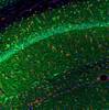 This antibody stained colchicine injected mouse brain (hippocampus CA1 region) tissue. The primary antibody was incubated at 1.0 ug/ml overnight at 4˚C. This was followed by a peroxidase conjugated secondary antibody and then a fluorescein Tyramide Signal Amplification (TSA) reagent. Optimal concentrations and conditions may vary.