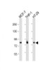 All lanes : Anti-IRAK1 Antibody at 1:2000 dilution Lane 1: MCF-7 whole cell lysates Lane 2: THP-1 whole cell lysates Lane 3: HT-29 whole cell lysates Lysates/proteins at 20 µg per lane. Secondary Goat Anti-Rabbit IgG, (H+L) , Peroxidase conjugated at 1/10000 dilution. Predicted band size : 77 kDa Blocking/Dilution buffer: 5% NFDM/TBST.