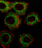 Fluorescent image of A549 cell stained with FADS2 Antibody (N-term) . A549 cells were fixed with 4% PFA (20 min) , permeabilized with Triton X-100 (0.1%, 10 min) , then incubated with FADS2 primary antibody (1:25) . For secondary antibody, Alexa Fluor 488 conjugated donkey anti-rabbit antibody (green) was used (1:400) .Cytoplasmic actin was counterstained with Alexa Fluor 555 (red) conjugated Phalloidin (7units/ml) .FADS2 immunoreactivity is localized to Cytoplasm and Vesicles significantly.