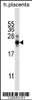 Western blot analysis in human placenta tissue lysates (35ug/lane) .This demonstrates the detected the CGB/HCG-Beta protein (arrow) .