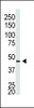 Western blot analysis of anti-GJA5 N-term Pab in Placenta lysate