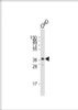 Western Blot at 1:2000 dilution + CHO whole cell lysate Lysates/proteins at 20 ug per lane.