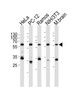 Western blot analysis of lysates from HeLa, rat PC-12, Ramos, mouse NIH/3T3 cell line, mouse brain tissue lysate (from left to right) , using PKM2-N491 at 1:1000 at each lane.