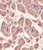 Antibody staining SPHK1 in human heart tissue sections by Immunohistochemistry (IHC-P - paraformaldehyde-fixed, paraffin-embedded sections) .