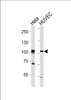 Western blot analysis of lysates from Hela, HUVEC cell line (from left to right) , using EPHA4 Antibody (R890) at 1:1000 at each lane.