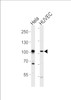 Western blot analysis of lysates from Hela, HUVEC cell line (from left to right) , using EPHA4 Antibody (R890) at 1:1000 at each lane.