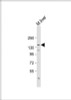 Western Blot at 1:2000 dilution + mouse liver lysate Lysates/proteins at 20 ug per lane.