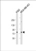 Western Blot at 1:2000 dilution Lane 1: K562 whole cell lysate Lane 2: MDA-MB-453 whole cell lysate Lysates/proteins at 20 ug per lane.