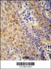Formalin-fixed and paraffin-embedded human Skin reacted with GC Antibody, which was peroxidase-conjugated to the secondary antibody, followed by DAB staining.