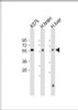 Western Blot at 1:2000 dilution Lane 1: A375 whole cell lysate Lane 2: human brain lysate Lane 3: human liver lysate Lysates/proteins at 20 ug per lane.