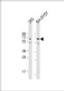 Western Blot at 1:2000 dilution Lane 1: 293 whole cell lysate Lane 2: SH-SY5Y whole cell lysate Lysates/proteins at 20 ug per lane.