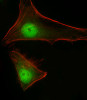 Immunofluorescent analysis of 4% paraformaldehyde-fixed, 0. 1% Triton X-100 permeabilized Hela cells labeling STAT1 with 64-232 at 1/25 dilution, followed by Dylight® 488-conjugated goat anti-Rabbit IgG secondary antibody at 1/200 dilution (green) . Immunofluorescence image showing Nucleus and Weak Cytoplasm staining on Hela cell line. Cytoplasmic actin is detected with Dylight® 554 Phalloidin (red) . The nuclear counter stain is DAPI (blue) .