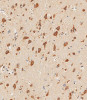 Immunohistochemical analysis of paraffin-embedded human brain tissue using 64-232 performed on the Leica® BOND RXm. Samples were incubated with primary antibody (1/500) for 1 hours at room temperature. A undiluted biotinylated CRF Anti-Polyvalent HRP Polymer antibody was used as the secondary antibody.