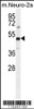 Western blot analysis in mouse Neuro-2a cell line lysates (35ug/lane) .This demonstrates the PRMT1 antibody detected the PRMT1 protein (arrow) .