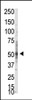 Western blot analysis of anti-PRMT3 Pab in whole HL60 cell lysate: PRMT3 was detected using purified Pab.