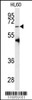 Western blot analysis of anti- in HL60 cell line lysates (35ug/lane) .