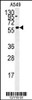 Western blot analysis in A549 cell line lysates (35ug/lane) .