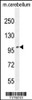 Western blot analysis in mouse cerebellum tissue lysates (35ug/lane) .