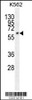 Western blot analysis in K562 cell line lysates (35ug/lane) .