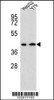 Western blot analysis in HepG2, Y79 cell line lysates (35ug/lane) .